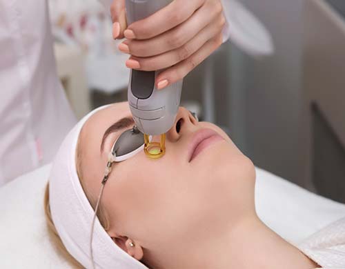 Tetra CO2 Cool Peel Laser